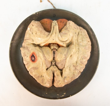 Vintage Ceramic Medical Model