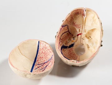 Anatomical Skull Model in Case