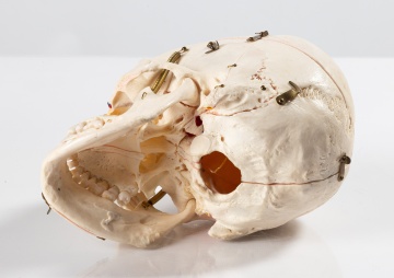 Anatomical Skull Model in Case